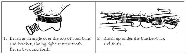 Bushing with braces.jpg